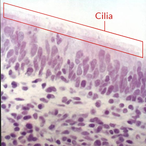 Normal swine turbinate ciliated epithelium Note the healthy ciliated brush border and the curvature in the cilia illustrating the beating or sweeping action which constantly moves the mucous layer and its trapped bacteria and particles toward the throat where it is swallowed and eliminated.